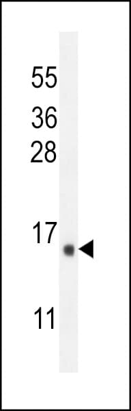 Polyclonal Rabbit anti-Human IER3 / IEX-1 Antibody (aa38-65, IHC, IF, WB)