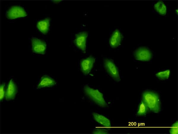 IHC-plus™ Monoclonal Mouse anti-Human G3BP1 / G3BP Antibody (clone 2F3, IHC, IF, WB)