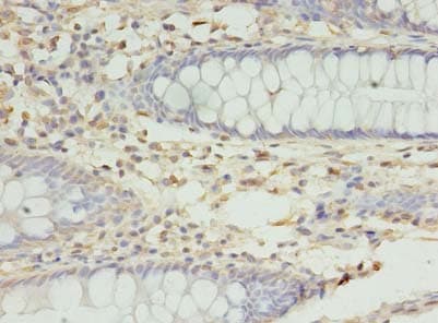 RMND5B Antibody