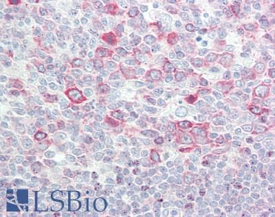 IHC-plus™ Polyclonal Rabbit anti-Human ERIC-1 / TACC3 Antibody (aa425-475, IHC, WB)