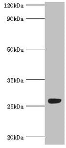 Polyclonal Rabbit anti-Human HBP17 / FGFBP1 Antibody (aa22-232, IHC, WB)