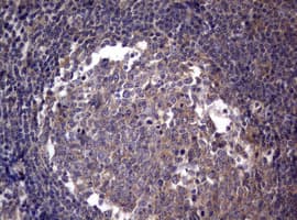 PIK3C2A Antibody (aa230-560, clone OTI3H2)