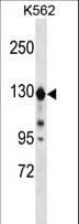 ESYT1 Antibody (aa1002-1031)