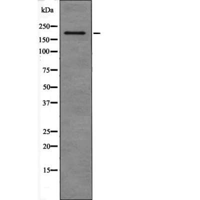 Polyclonal Rabbit anti-Human SNAPC4 Antibody (IHC, WB)