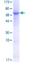 Human UPB1 Protein (Recombinant GST)