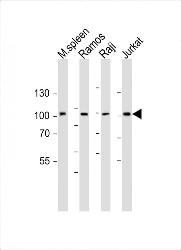 BCL6 Antibody (aa364-395)