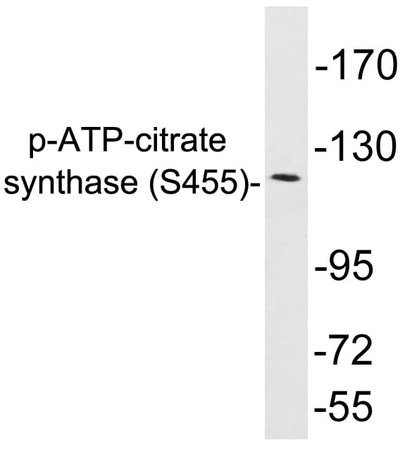 Polyclonal Rabbit anti-Human ACLY / ATP Citrate Lyase Antibody (phospho-Thr447, WB)
