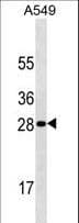 HPRT1 / HPRT Antibody (aa150-178)