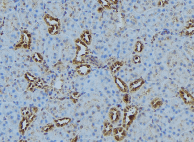 Polyclonal Rabbit anti-Human COX5B Antibody (IHC, WB)