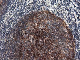 NAPE-PLD Antibody (clone OTI5F7)