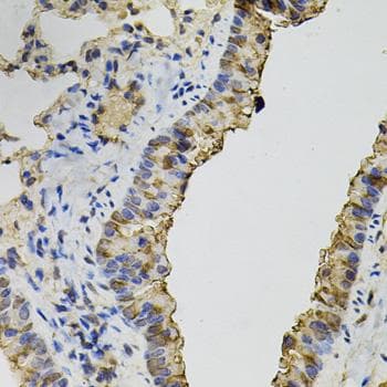 DNM2 / Dynamin-2 Antibody