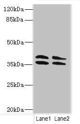 CA10 / Carbonic Andhydrase X Antibody