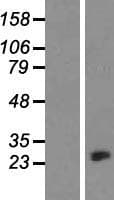 CRYBA1 Protein (Over-Expression Lysate Myc-DDK (Flag))
