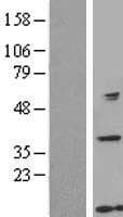 GTF2H5 Protein (Over-Expression Lysate Myc-DDK (Flag))
