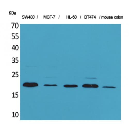 FGF20 Antibody (Internal)