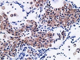 CD80 Antibody (clone OTI2B11)