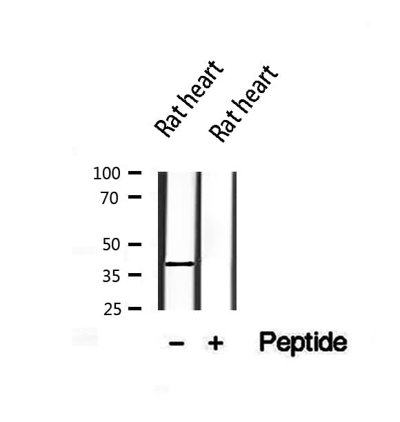CCN4 / WISP1 Antibody