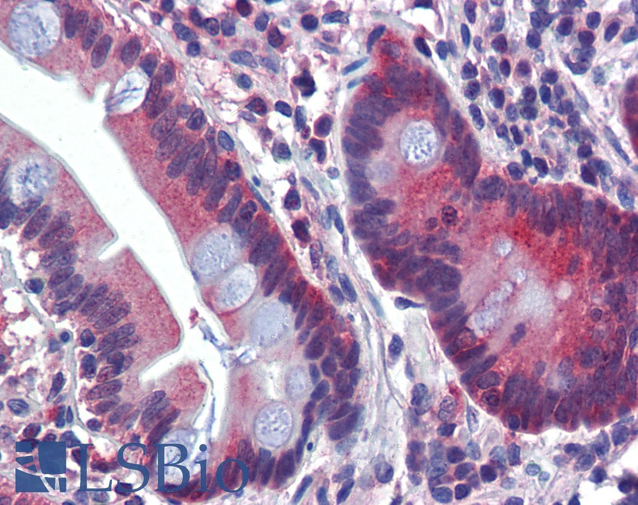 Polyclonal Rabbit anti-Human ATP6V0A2 Antibody (aa72-121, IHC, WB)