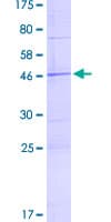 Human SAMD12 Protein (Recombinant GST)