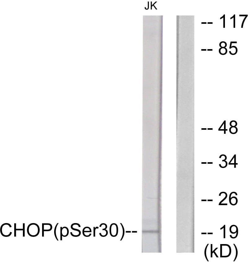 DDIT3 / CHOP Antibody (phospho-Ser30)