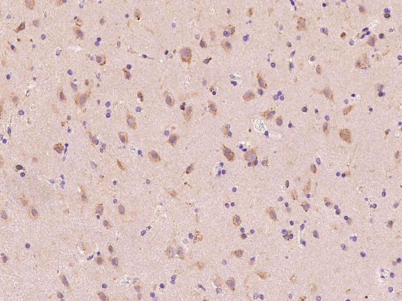 Polyclonal Rabbit anti-Human MKKS Antibody (IHC)