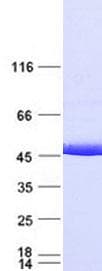 Human IDH1 / IDH Protein (Recombinant Myc-DDK (Flag), C-terminus)