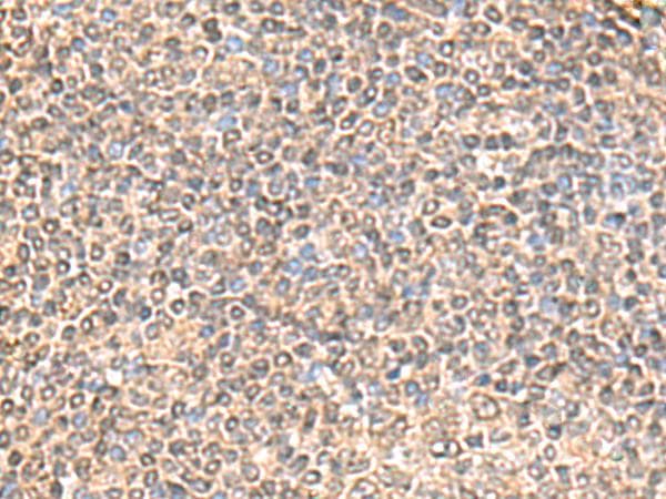 Polyclonal Rabbit anti-Human IQCD Antibody (IHC, WB)