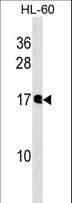 NUDT10 Antibody (aa1-30)