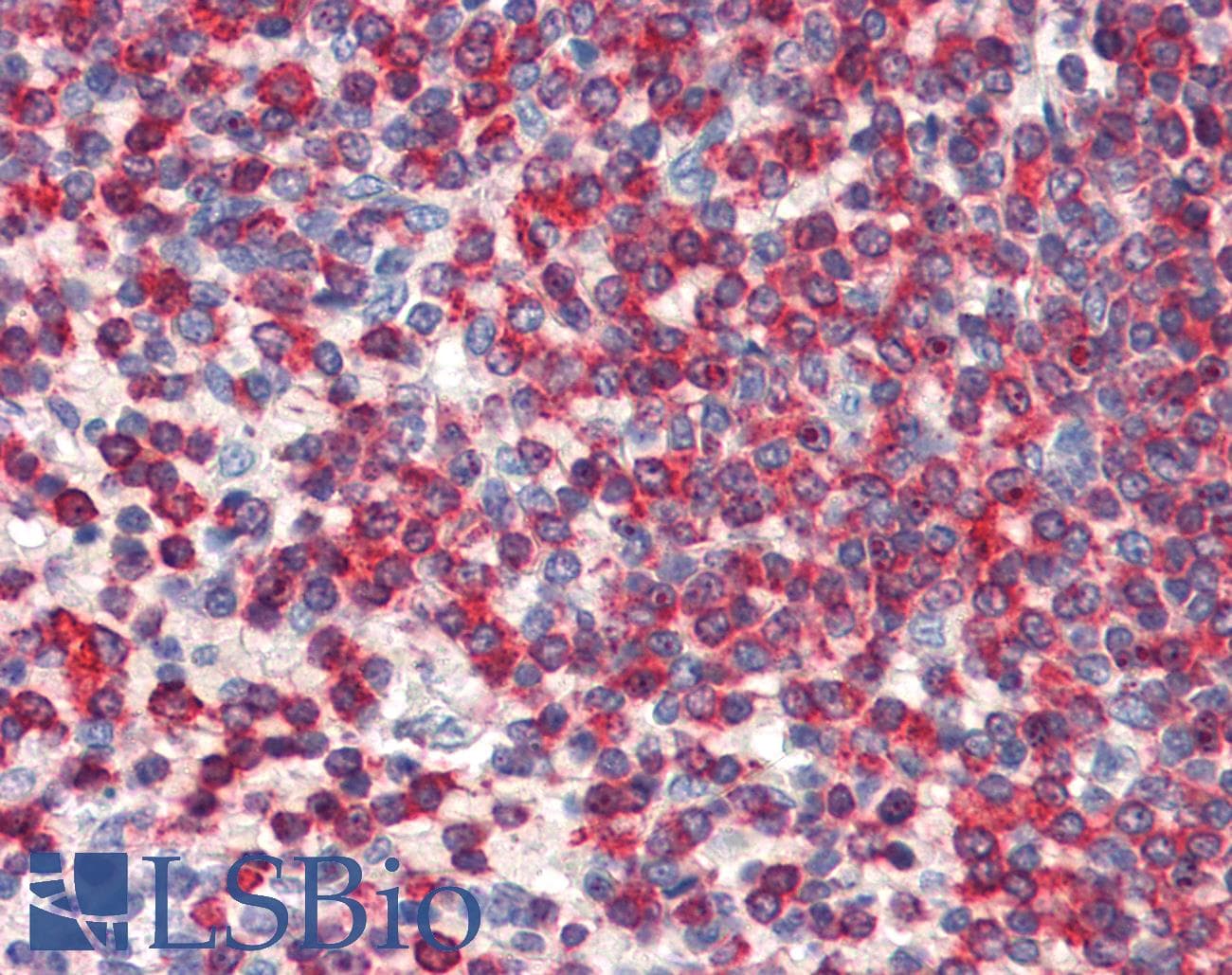 WDHD1 Antibody (C-Terminus)