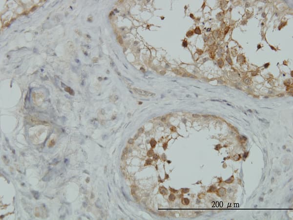 AKAP10 Antibody (clone 8C10)