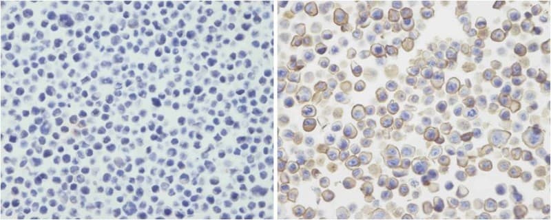 PD-L2 / PDCD1LG2 / CD273 Antibody (N-Terminus, clone 2011CT241.19.54)