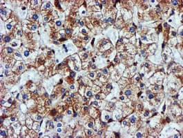 CYB5R3 / B5R Antibody (clone OTI1E8)