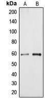 CYP4A11+22 Antibody (Internal)