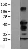 Human ZFYVE27 / Protrudin Protein (Over-Expression Lysate Myc-DDK (Flag))