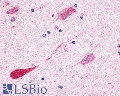 PathPlus™ GPR1 Antibody (C-Terminus)