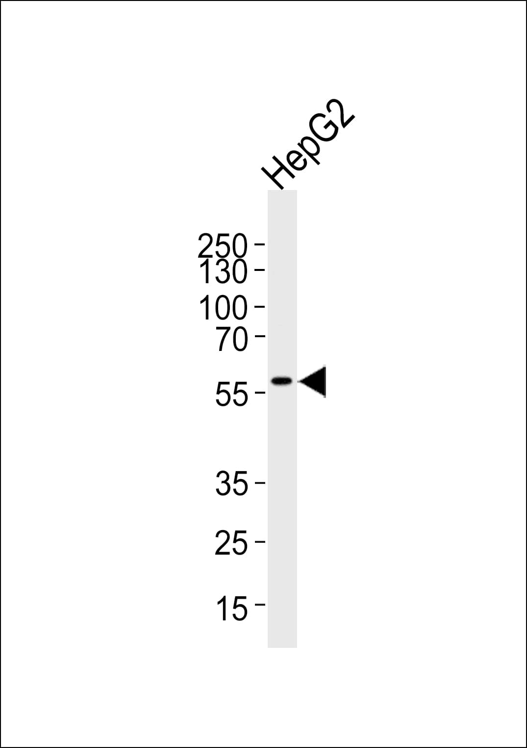 Polyclonal Rabbit anti-Human MLLT3 / AF9 Antibody (aa407-438, WB)