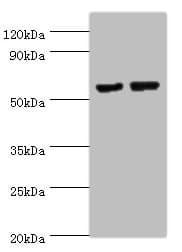MATN3 / Matrilin 3 Antibody (aa277-486)