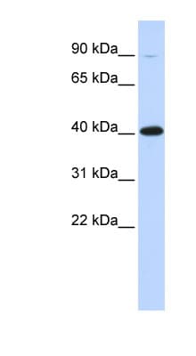 ZFP42 / REX-1 Antibody (aa108-157)