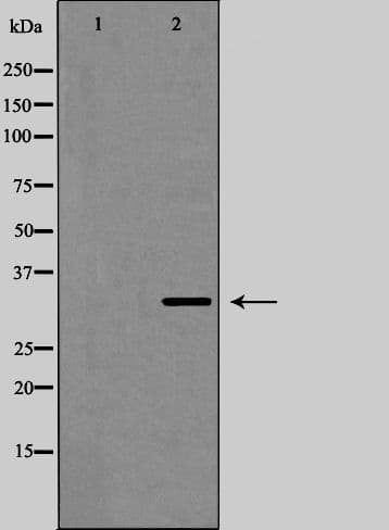 GJB1 / CX32 / Connexin 32 Antibody