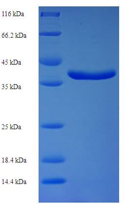 Human HsT19268 / MTHFS Protein (Recombinant His-SUMO)