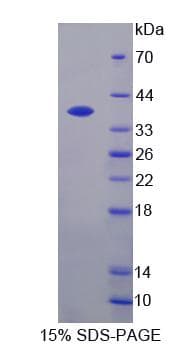 Rat CXCL11 Protein (Recombinant His-GST)