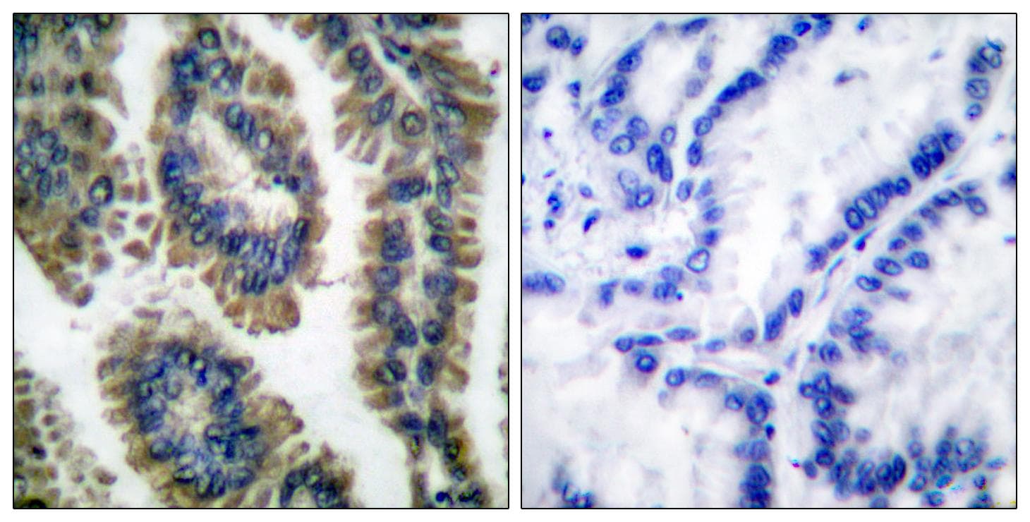 Polyclonal Rabbit anti-Human STAT2 Antibody (phospho-Tyr690, IHC, WB)