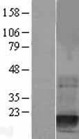 DSTN / Destrin Protein (Over-Expression Lysate Myc-DDK (Flag))
