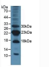 BIRC5 / Survivin Antibody (aa1-140, APC)