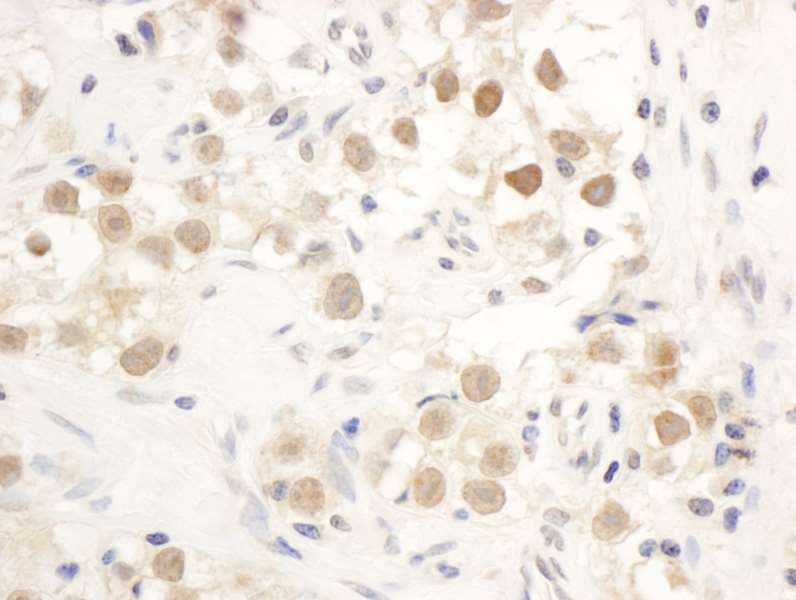 CHEK1 / CHK1 Antibody (aa250-300)