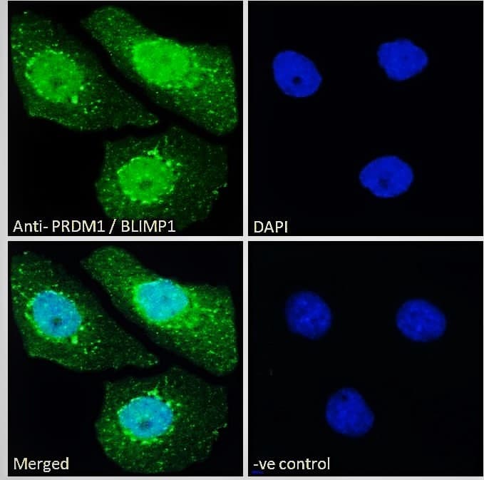 Polyclonal Goat anti-Human BLIMP1 / PRDM1 Antibody (aa778-789, IF)