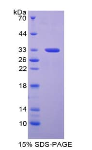 Mouse PPL / Periplakin Protein (Recombinant His-T7)