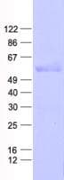 Human PAX6 Protein (Recombinant His, N-Terminal)