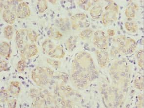 TPD52L1 Antibody