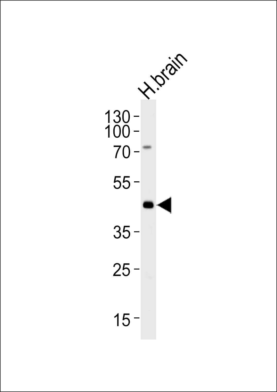 ELAVL3 / HUC Antibody (aa71-99)